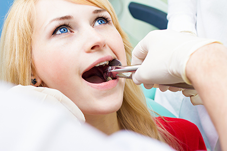 The image depicts a young woman receiving dental care from a professional wearing gloves, with her mouth open wide for the procedure.